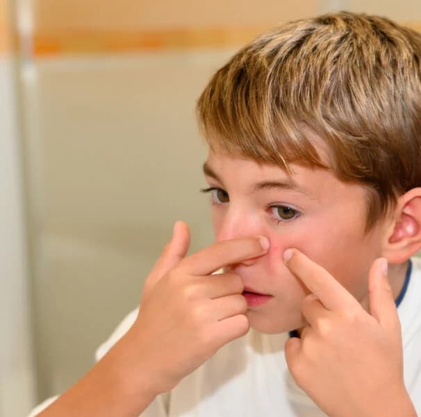 Puberdade precoce na infância: o que mudou depois da pandemia e como prevenir no consultório