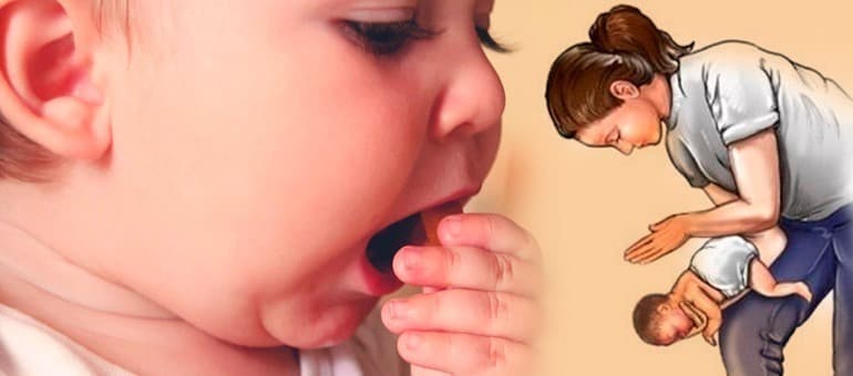 Engasgo em bebê com leite: por que a manobra de Heimlich não é indicada